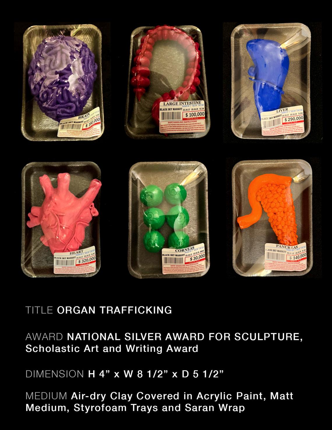 ORGAN TRAFFICING